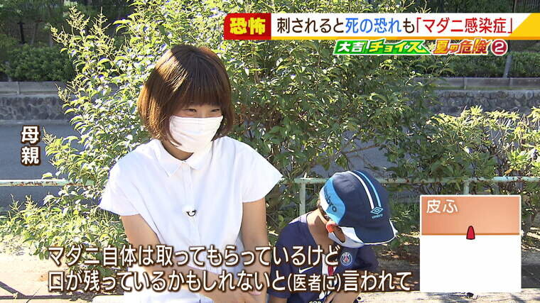 マダニ_000-000337735.jpg