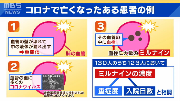 解説 長期間体内にウイルスが残り続ける 持続感染 の脅威 一方で ミルナイン みれば事前にわかる 重症化予測 と 入院日数 特集 Mbsニュース