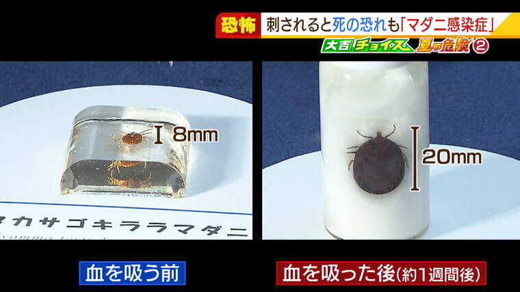 感染 症 マダニ 本当は怖い。マダニの感染症「重症熱性血小板減少症候群（SFTS）」